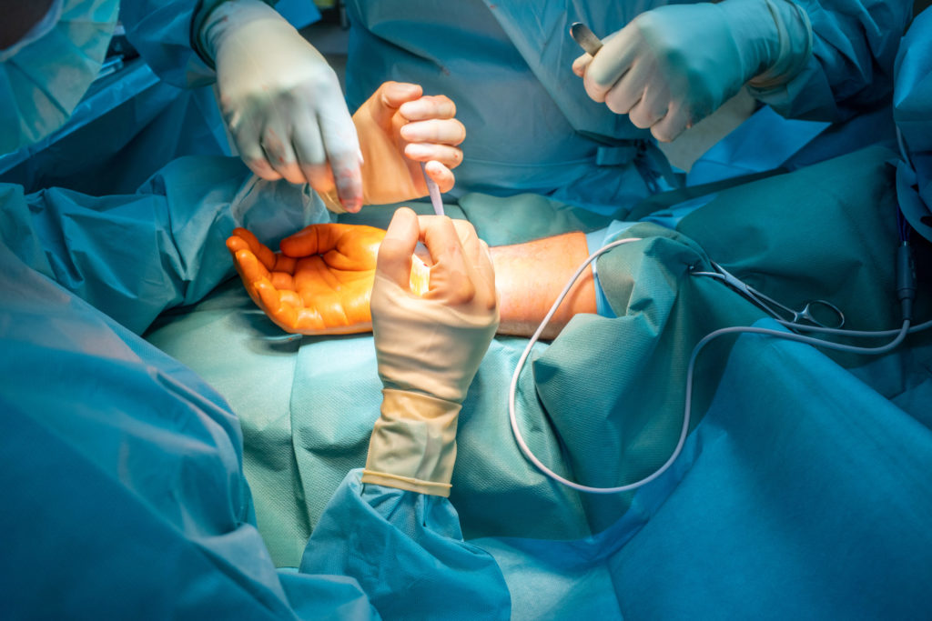  Close up of orthopedic surgeons working on treating Dupuytren's contracture in the operating room.